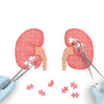 end-stage-renal-disease-causes-symptoms-prevention