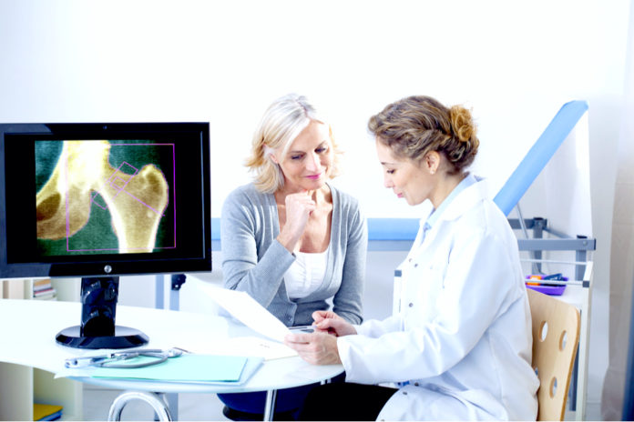 Doctor and patient reviewing x-ray, both female